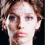 A woman with plastic surgery marks.